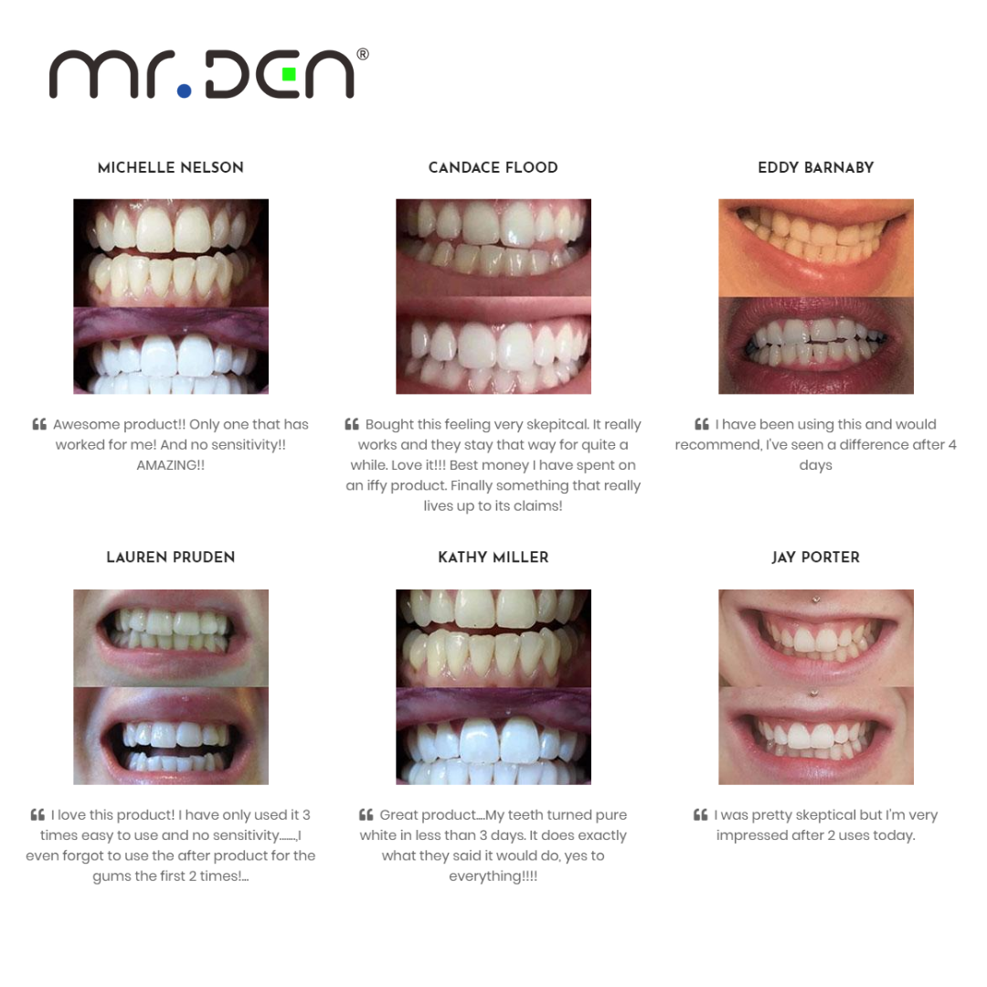 Dr. Whiten 3 Pack Teeth Whiten - Teeth Whitening Light recensione e prezzo
