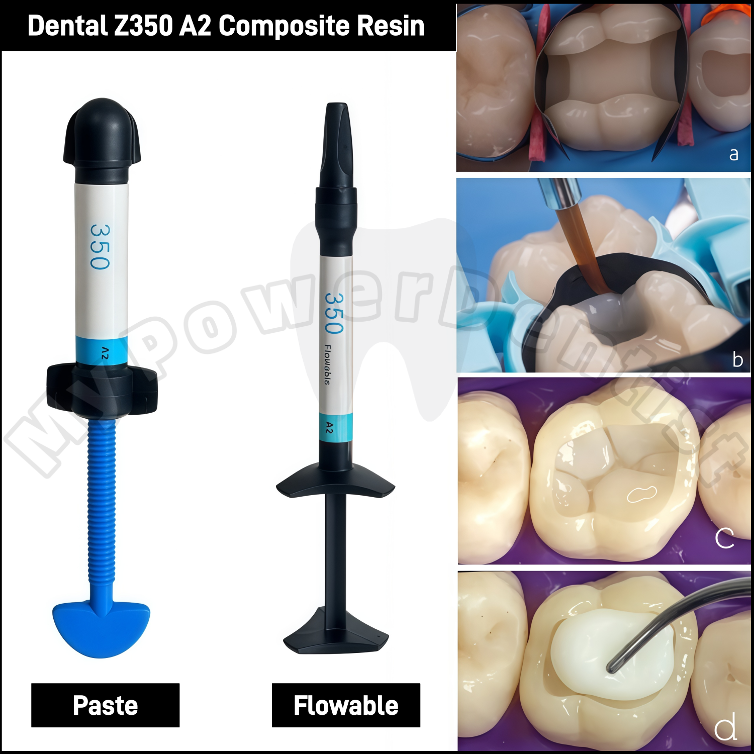 Z350 A2  Dental Composite Resi - Teeth Whitening Light recensione e prezzo