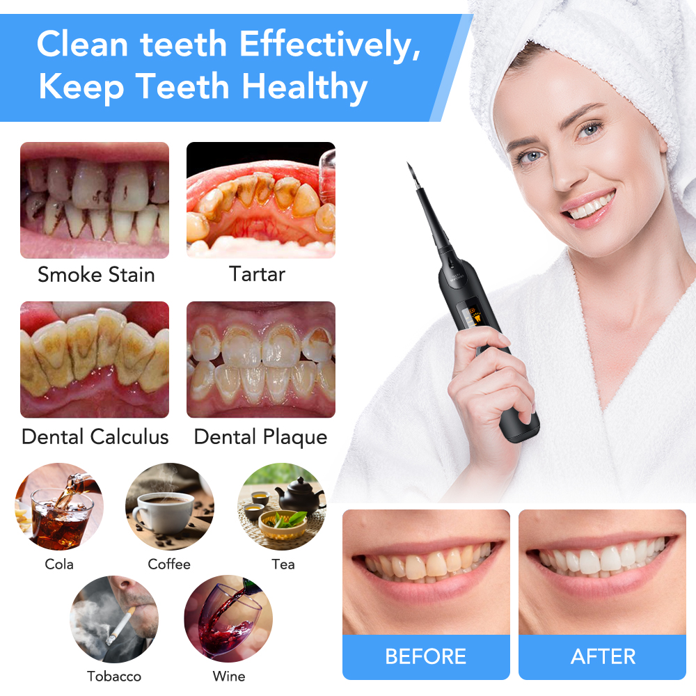 Teeth Tartar Remover Electric  - Teeth Whitening Home Kit recensione e prezzo