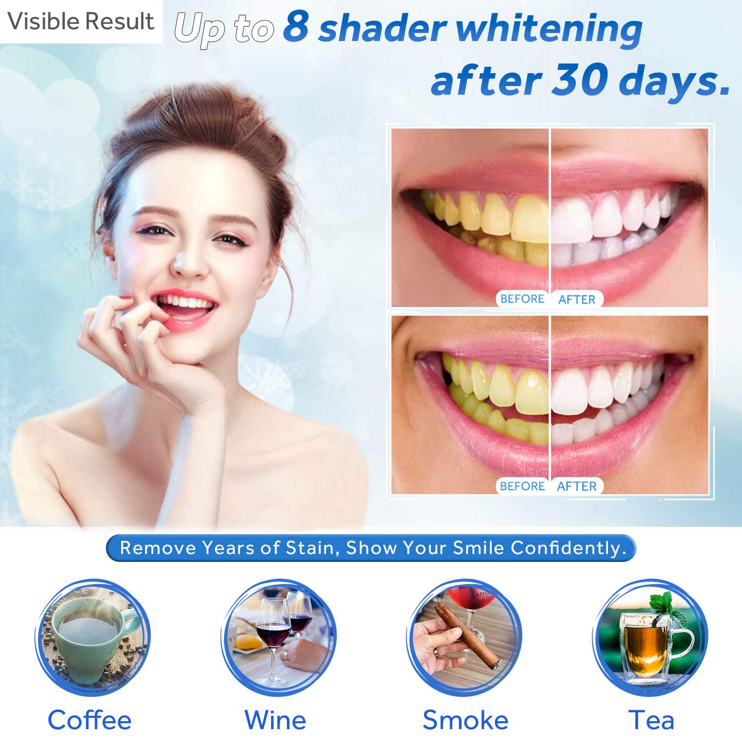Teeth Whitening Gel Refill Syr - Teeth Whitening Near Me recensione e prezzo