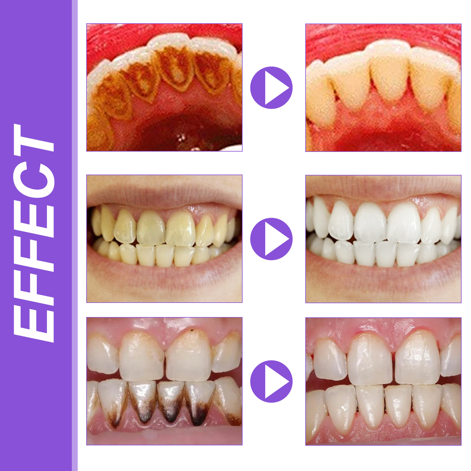 EELHOE Smiles Bright White Ref - Teeth Whitening Serum recensione e prezzo