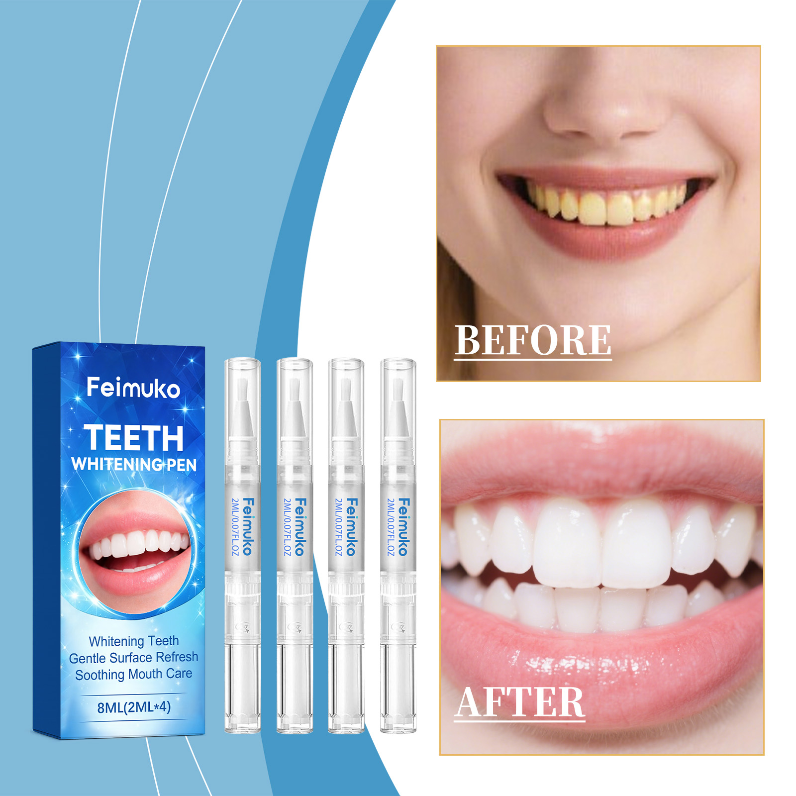 Feimuko 8ml Teeth Gel Pen Gent - Teeth Whitening Near Me recensione e prezzo