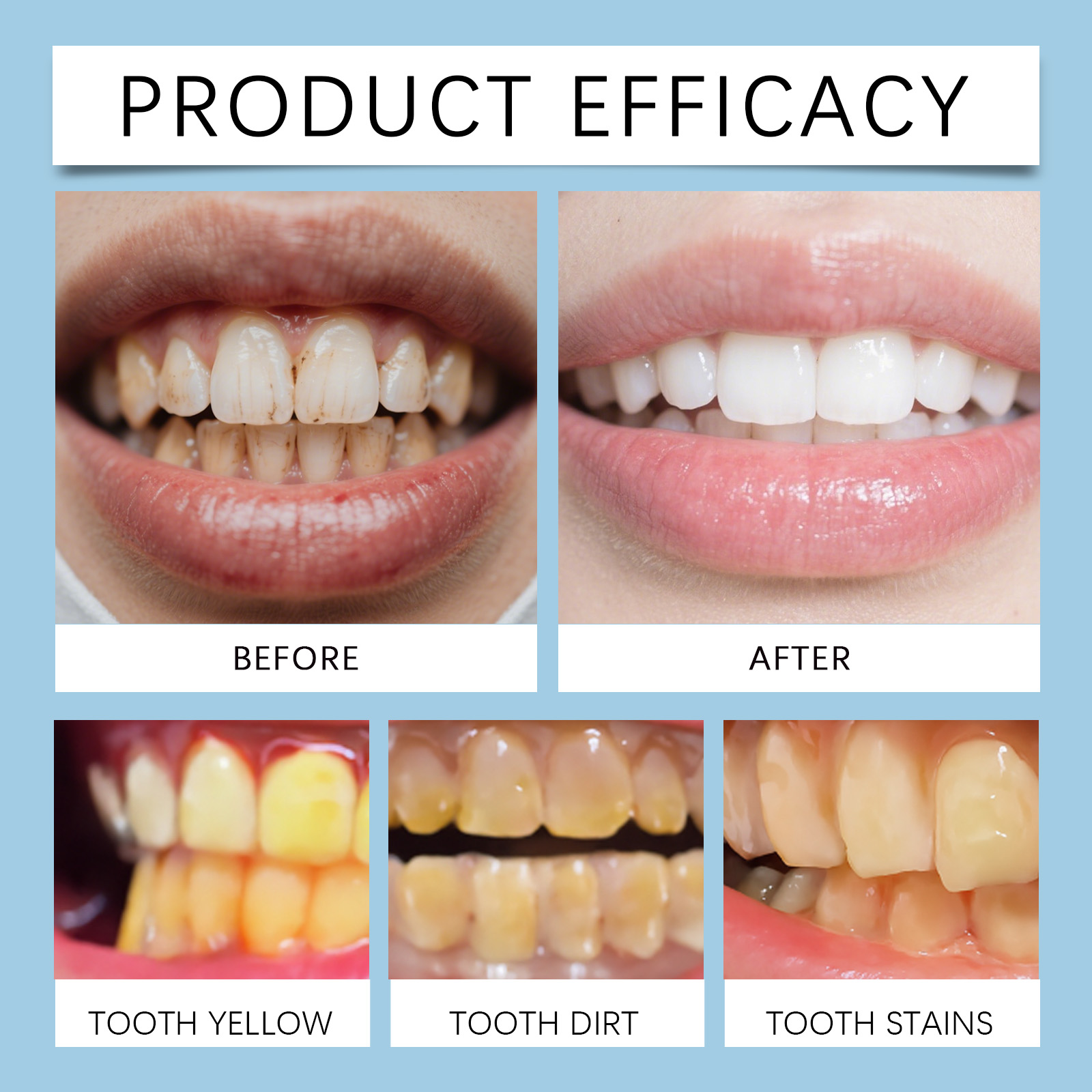 Feimuko 8ml Teeth Gel Pen Gent - Teeth Whitening Near Me recensione e prezzo