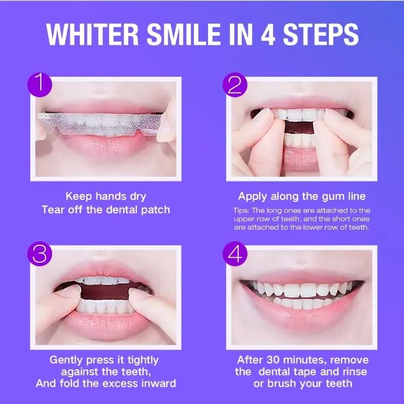 Teeth Whitening Kit - 5X LED L - Teeth Whitening Near Me recensione e prezzo