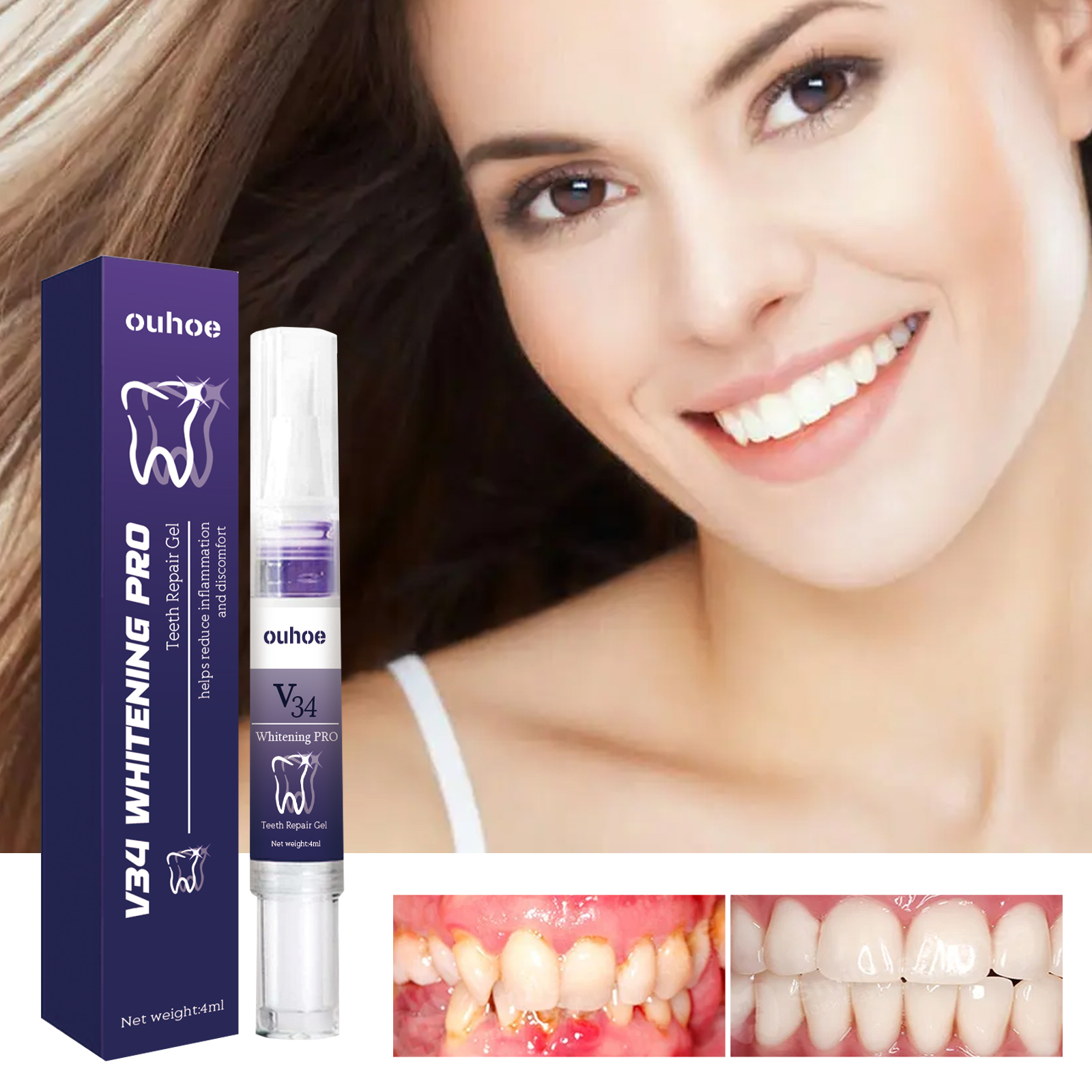 Rapid Repair Damaged Gums Gel  - Teeth Whitening Serum recensione e prezzo