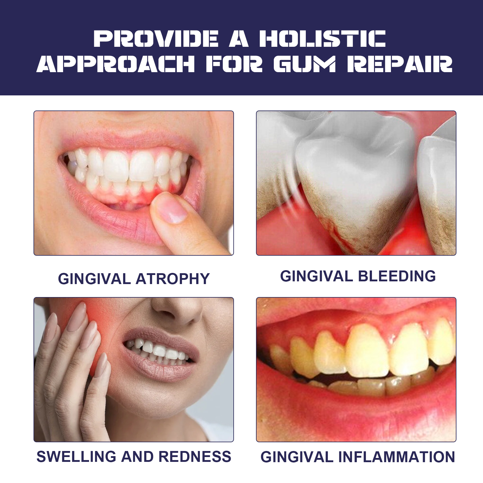 Rapid Repair Damaged Gums Gel  - Teeth Whitening Serum recensione e prezzo