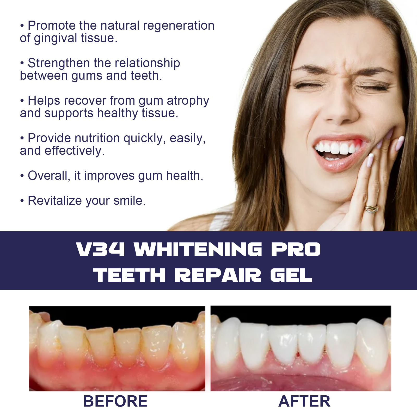 Rapid Repair Damaged Gums Gel  - Teeth Whitening Serum recensione e prezzo