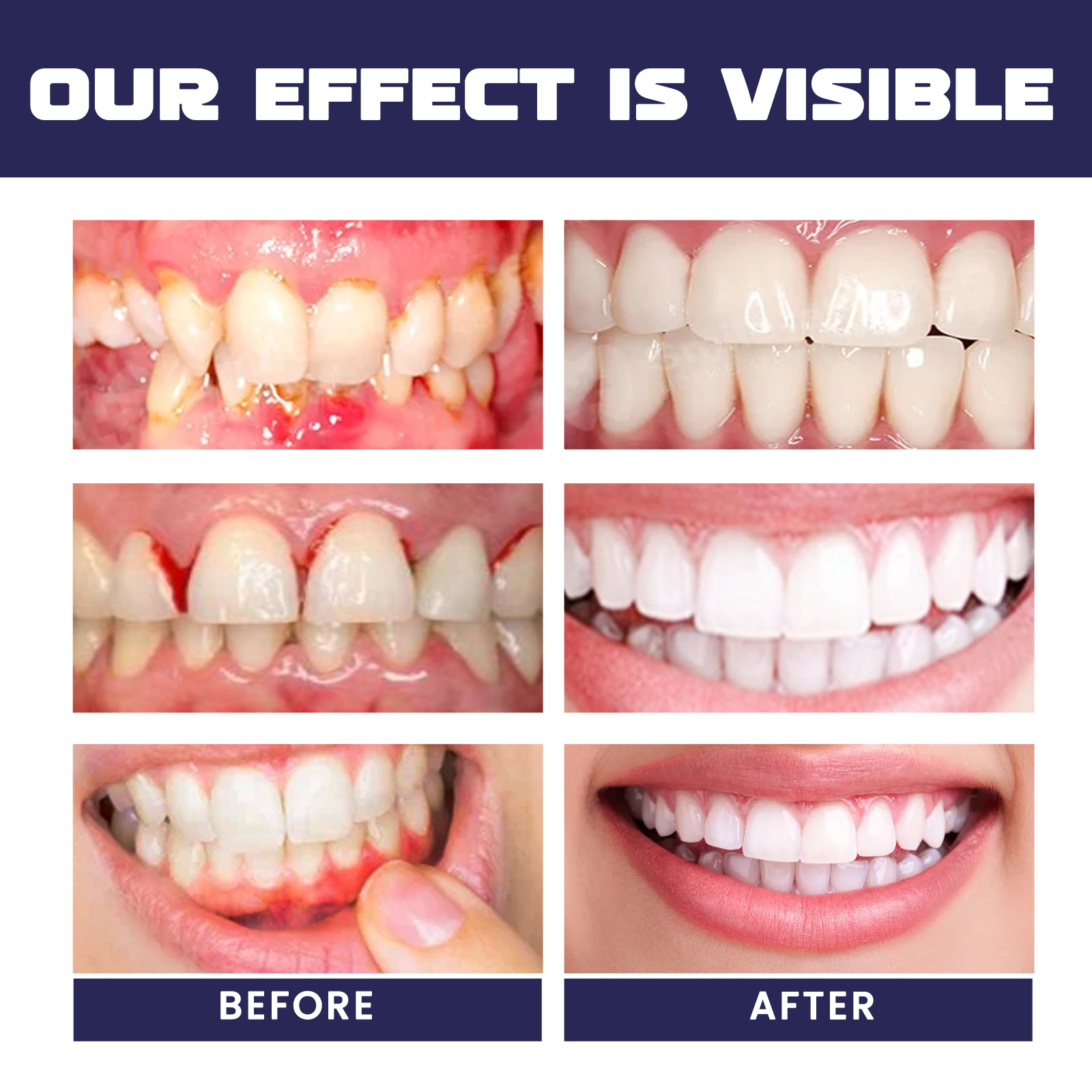 Rapid Repair Damaged Gums Gel  - Teeth Whitening Serum recensione e prezzo
