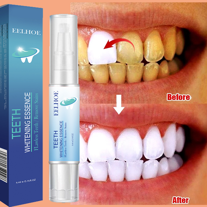 Teeth Whitening Pen Dental Ess - Teeth Whitening Serum recensione e prezzo