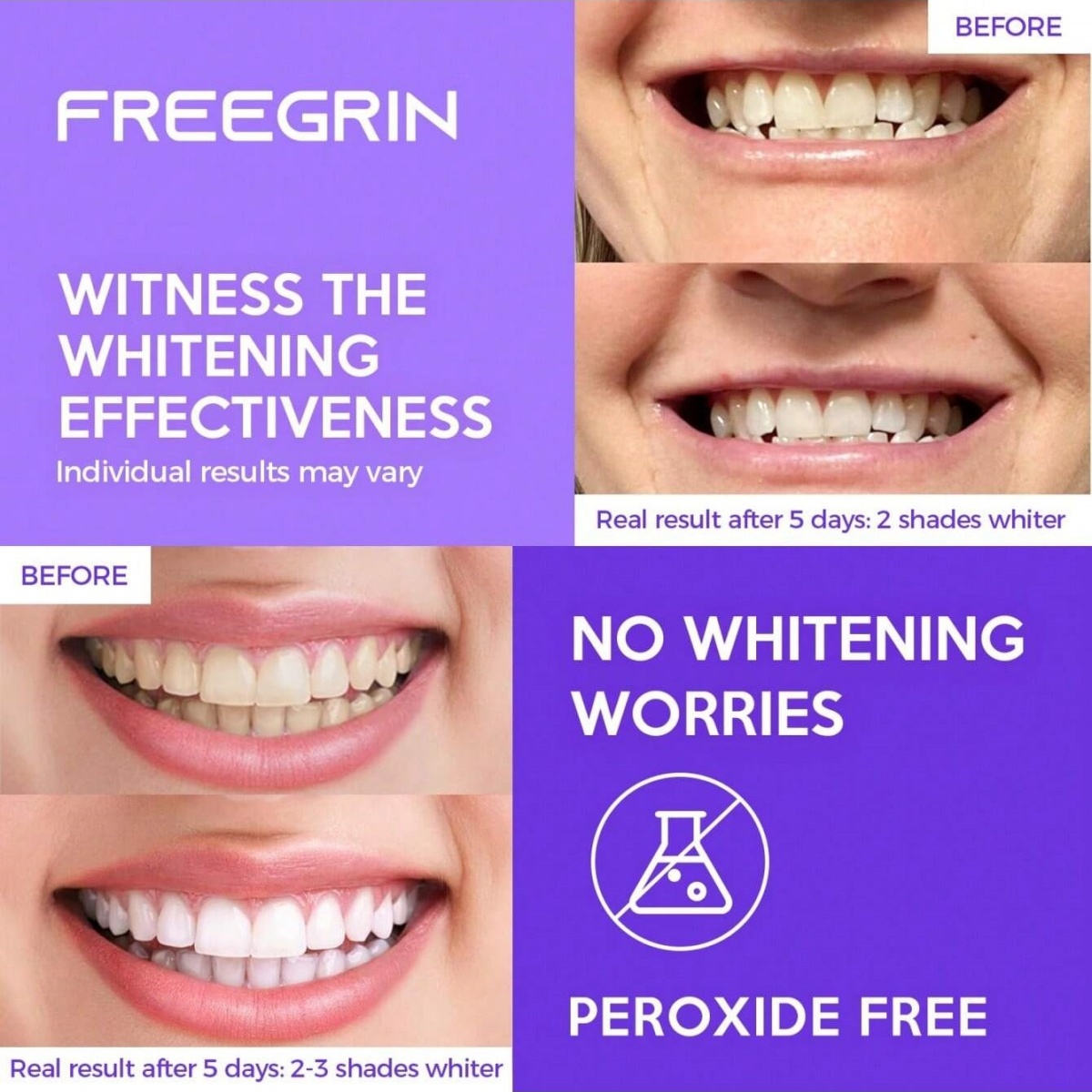 Deluxe Whitening Teeth Sticker - Teeth Whitening Near Me recensione e prezzo