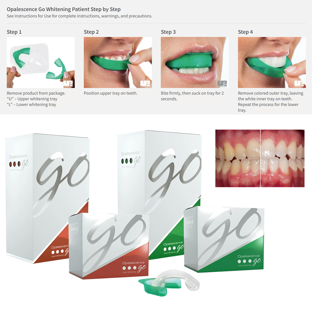 Opalescence Go Teeth Whitening - Teeth Whitening Home Kit recensione e prezzo