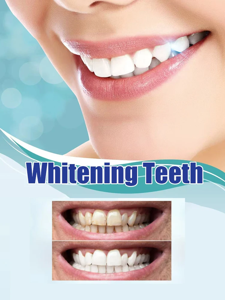 Newly Upgraded Teeth Whitening - Teeth Whitening Serum recensione e prezzo