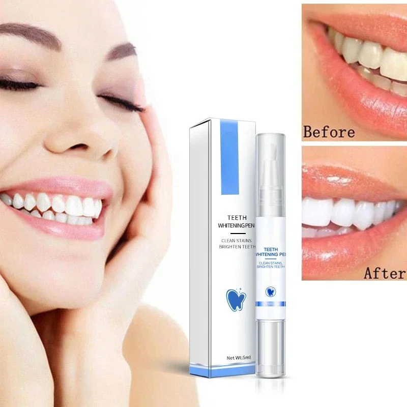 Teeth Whitening Pen Cleaning S - Teeth Whitening Serum recensione e prezzo