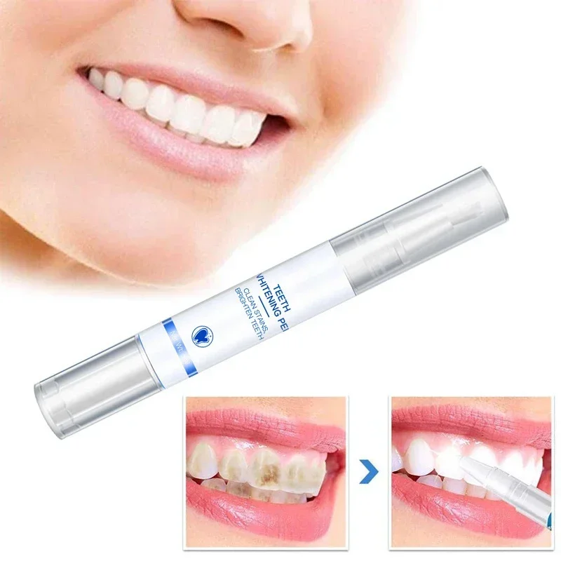 Teeth Whitening Pen Cleaning S - Teeth Whitening Serum recensione e prezzo