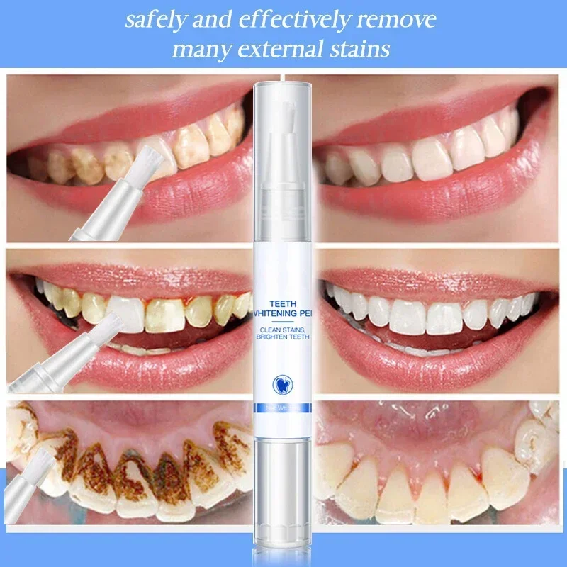 Teeth Whitening Pen Cleaning S - Teeth Whitening Serum recensione e prezzo