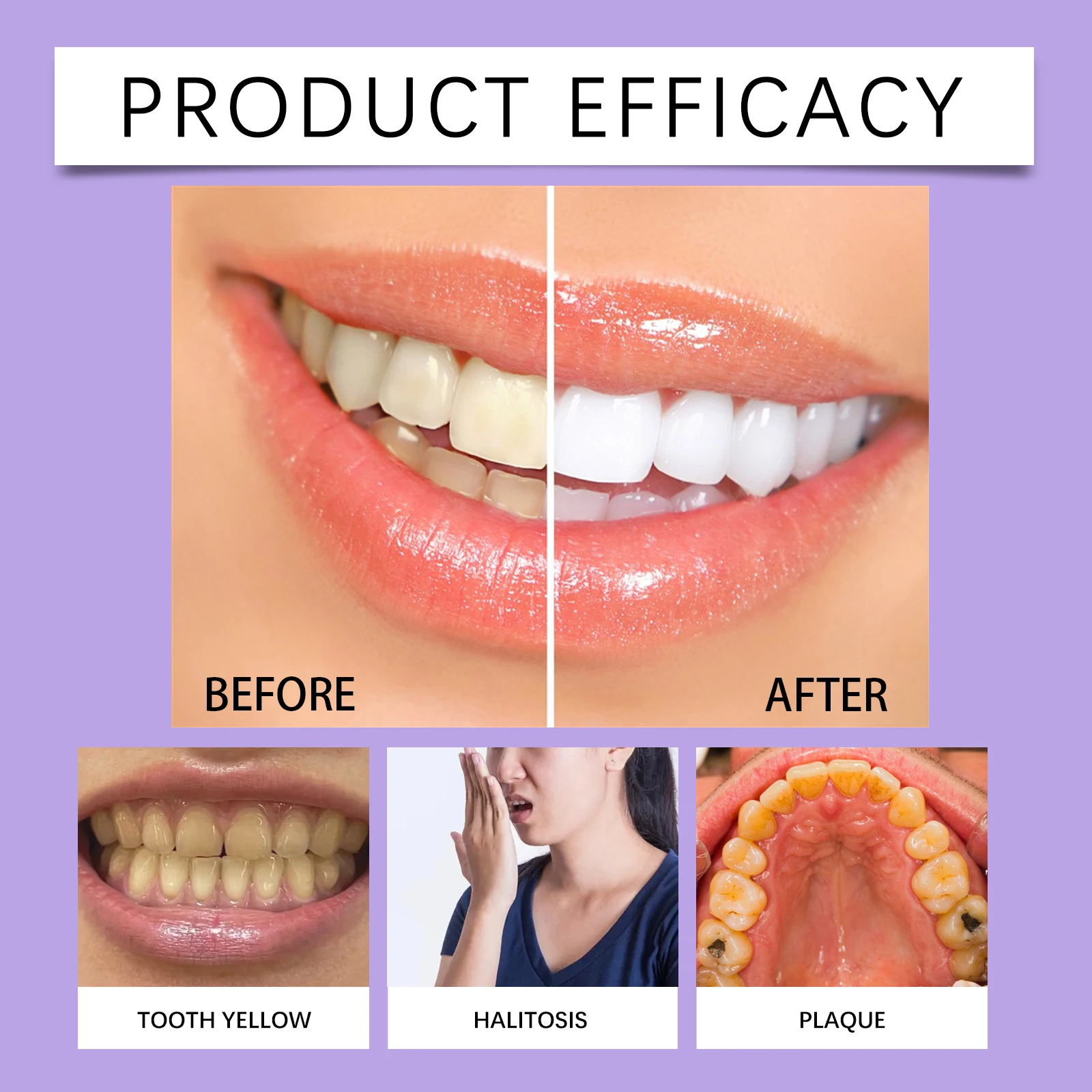 Teeth Whitening Pen Teeth Gel  - Teeth Whitening Serum recensione e prezzo
