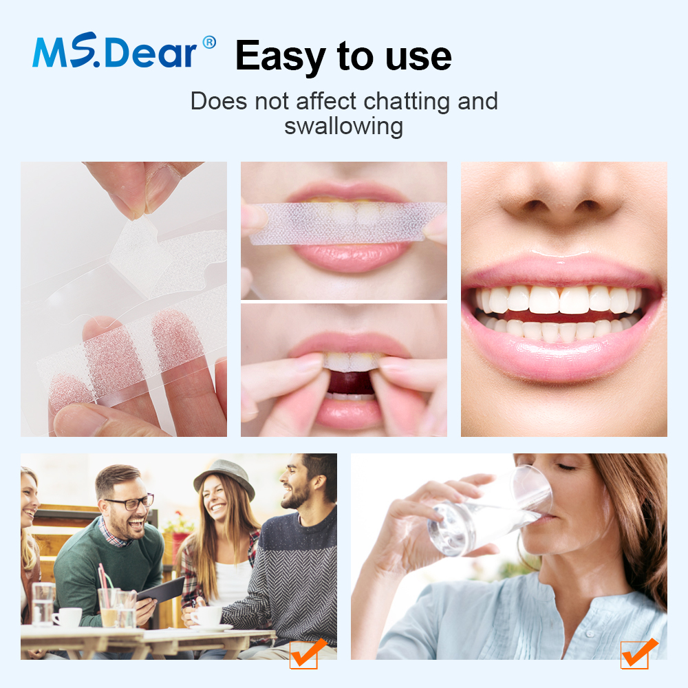 Teeth Whitening Strips Cleansi - Teeth Whitening Near Me recensione e prezzo